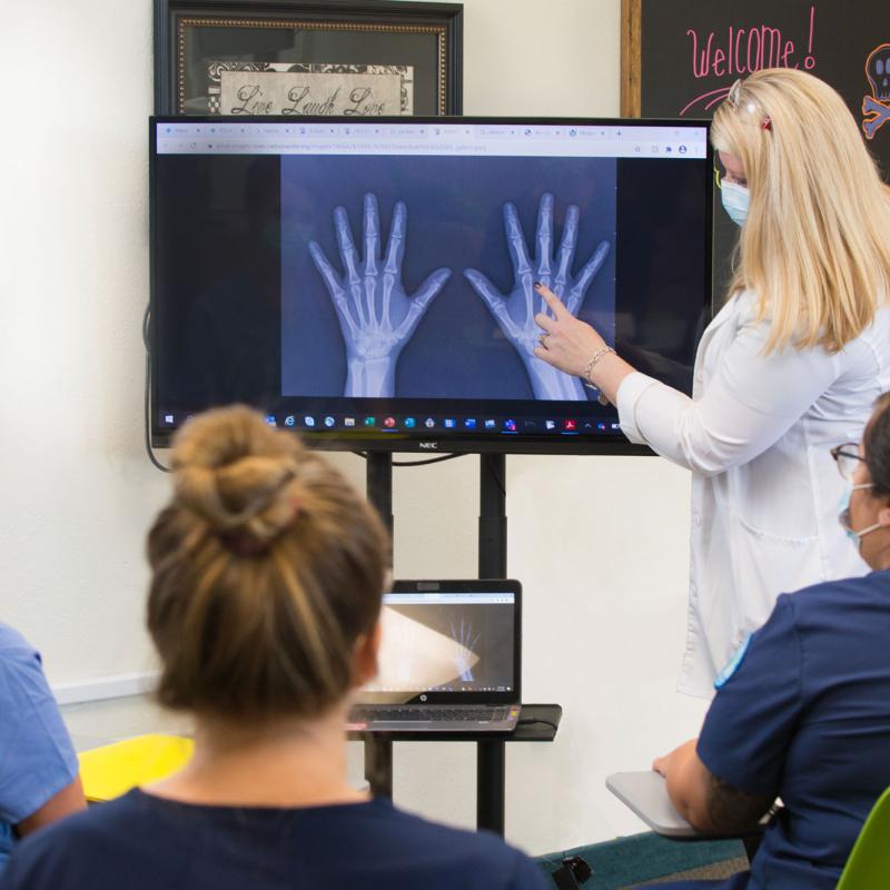 A radiography instructors showing students and x-ray of the hand